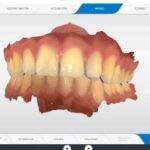 Digital Dentistry